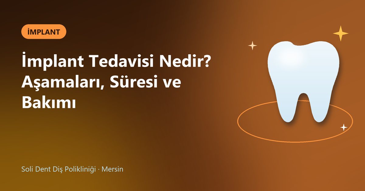 İmplant Tedavisi Nedir? Aşamaları, Süresi ve Bakımı – Soli Dent blog kapak görseli